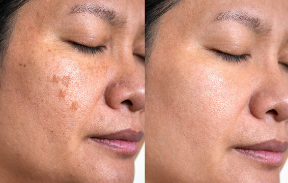 Dry skin result 5